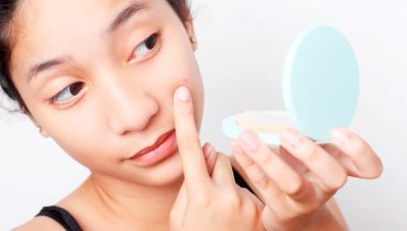 TOP INGREDIENTES CONTRA EL ACNE EN KBEAUTY (I)